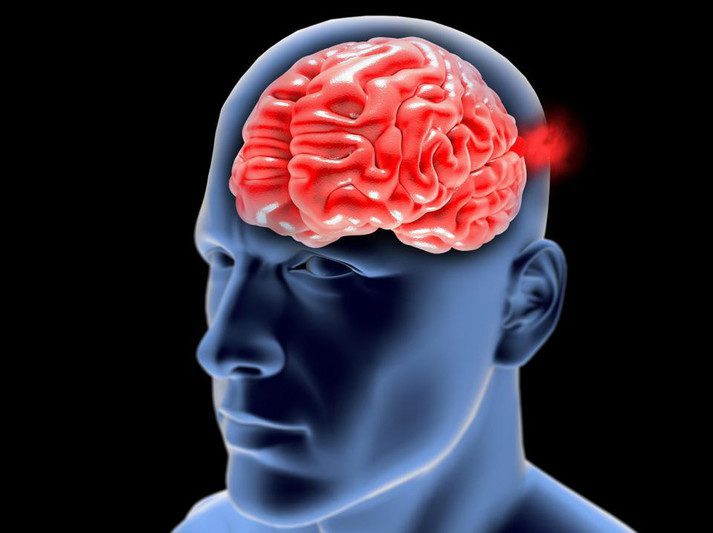 مضاعفات التمددات الشريانية في المخ