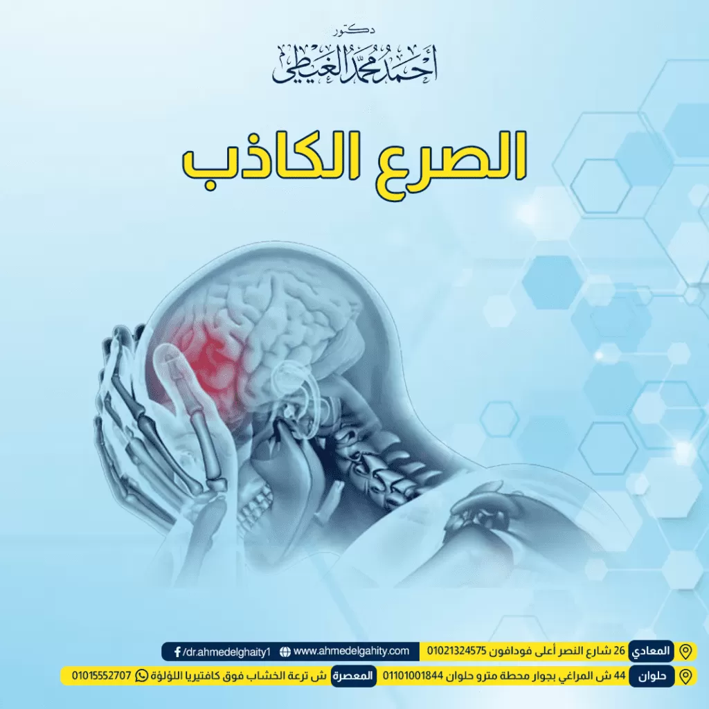 الصرع الكاذب