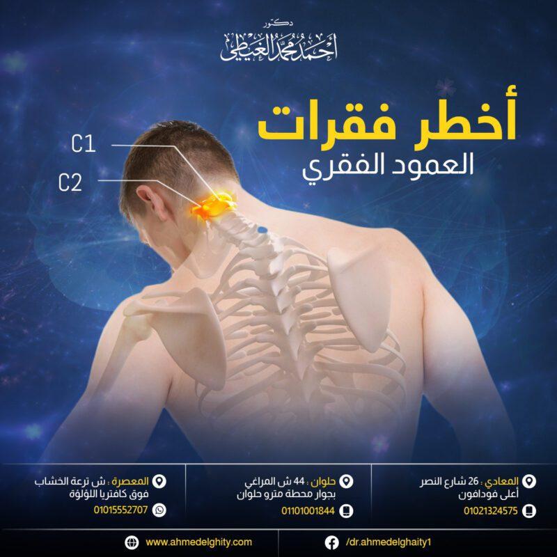 أخطر فقرات العمود الفقري - دكتور أحمد الغيطي أخطر فقرات العمود الفقري - دكتور أحمد الغيطي