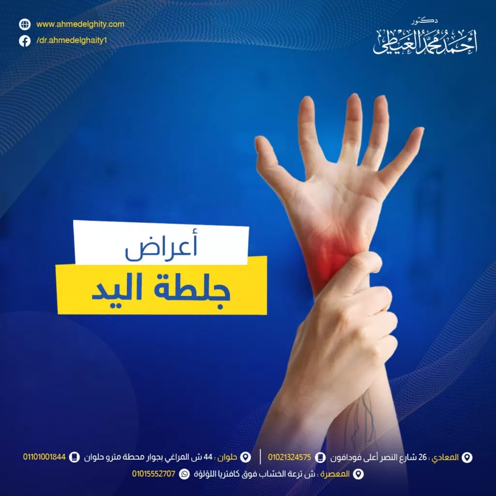 أعراض جلطة اليد