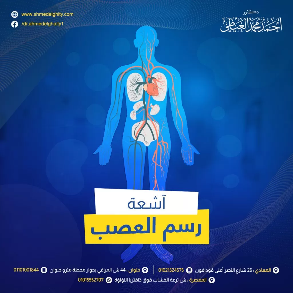 اشعة رسم العصب