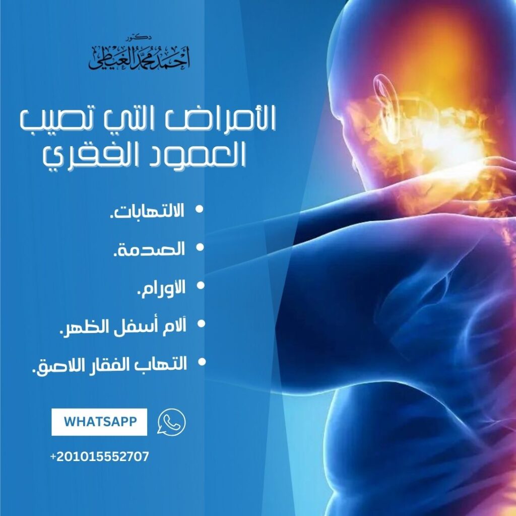 الأمراض التي تصيب العمود الفقري
