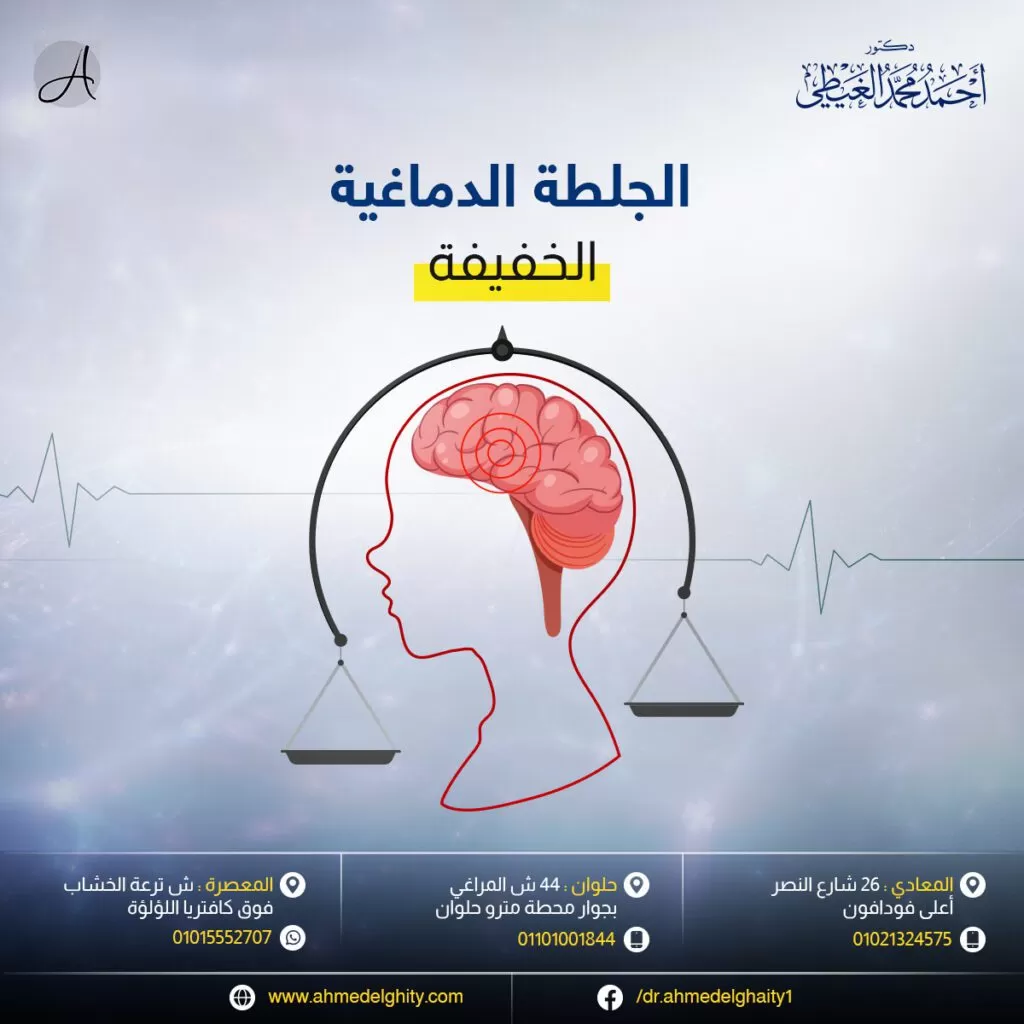 الجلطة الدماغية الخفيفة