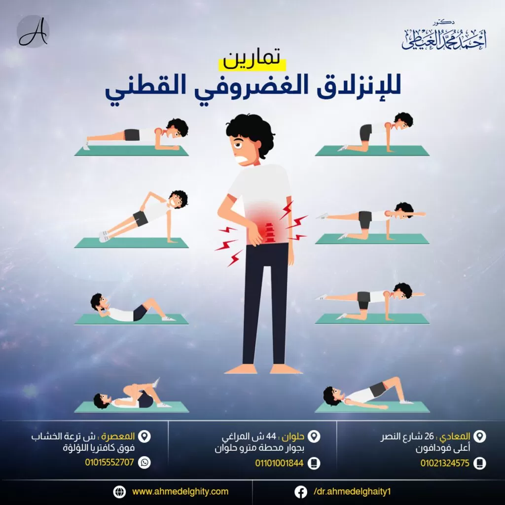 تمارين للانزلاق الغضروفي القطني