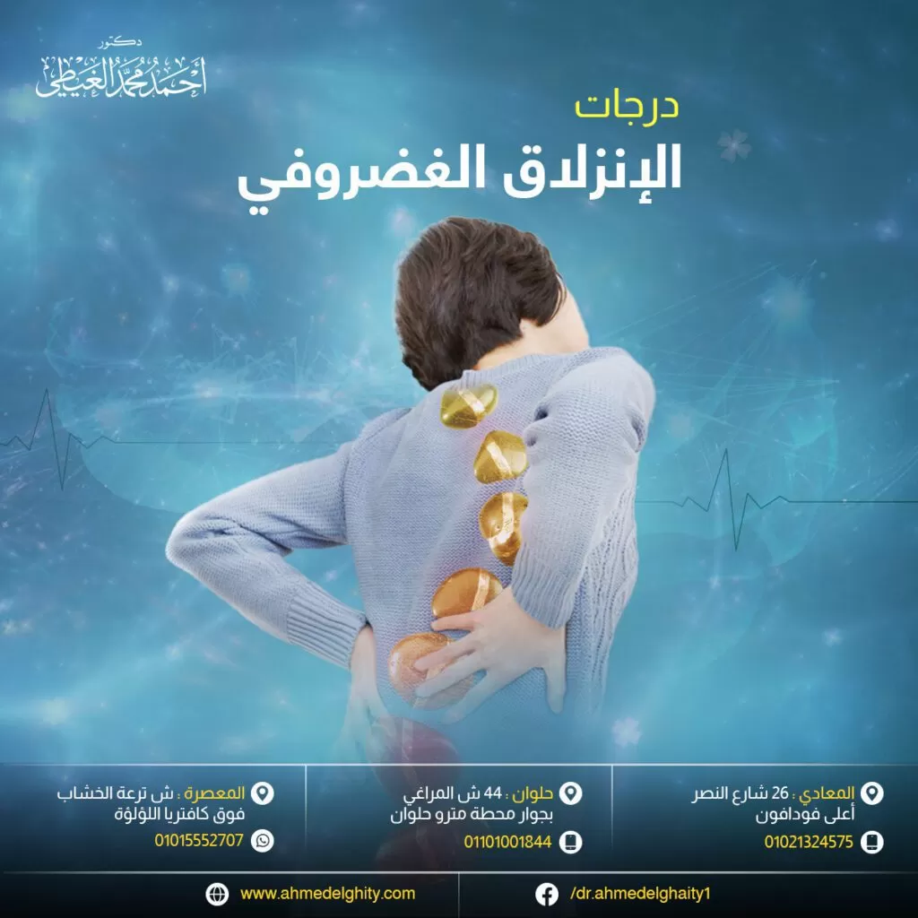 درجات الانزلاق الغضروفي