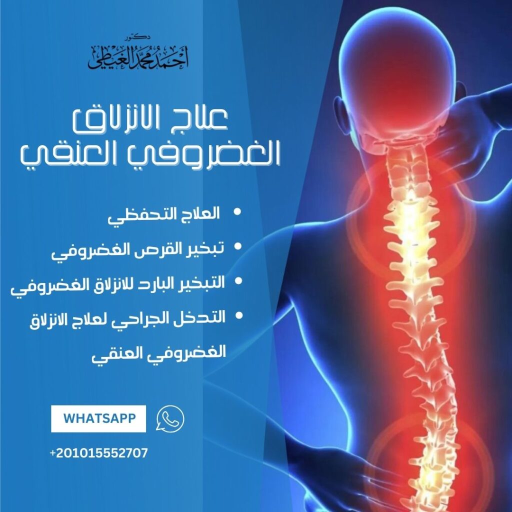 علاج الانزلاق الغضروفي العنقي 
