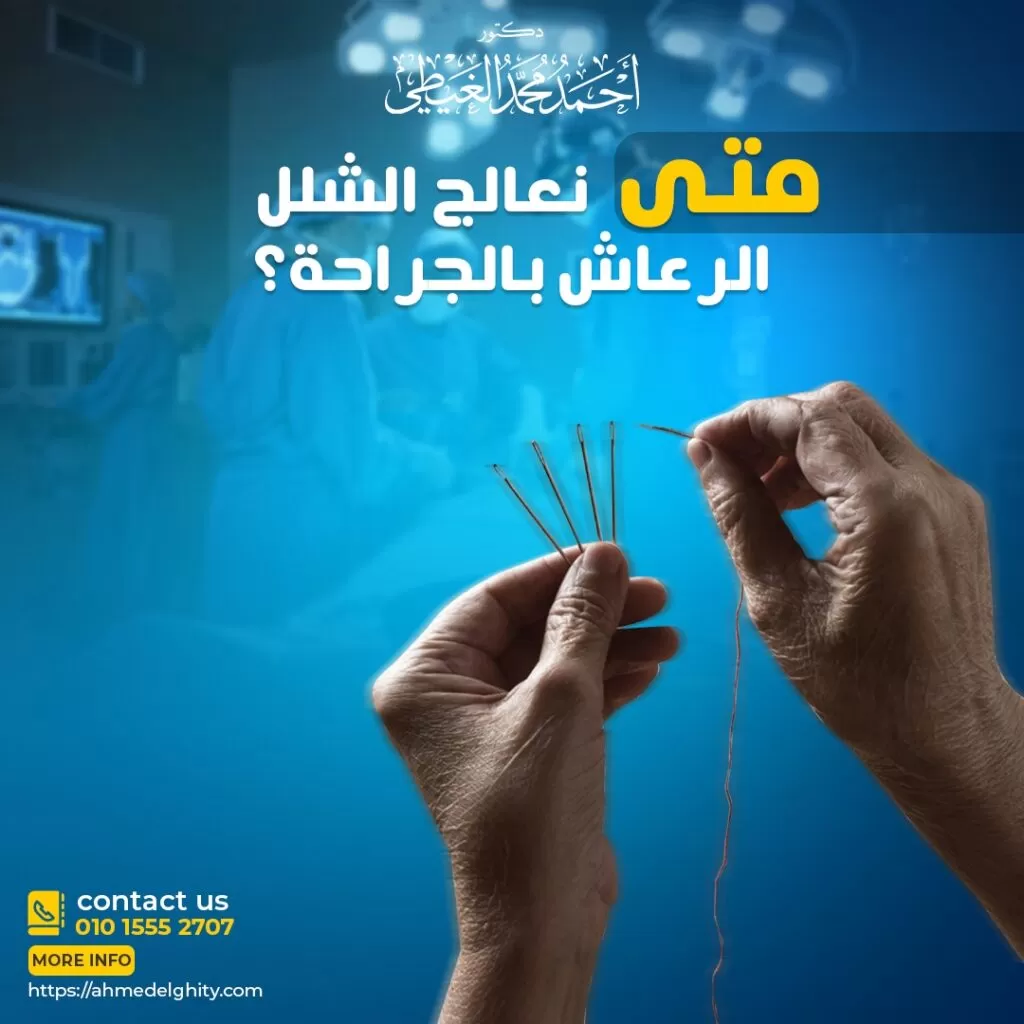 الشلل الرعاش