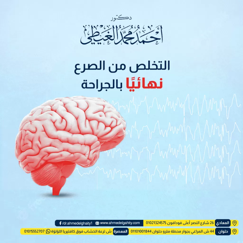 ما هي أسباب الصرع؟