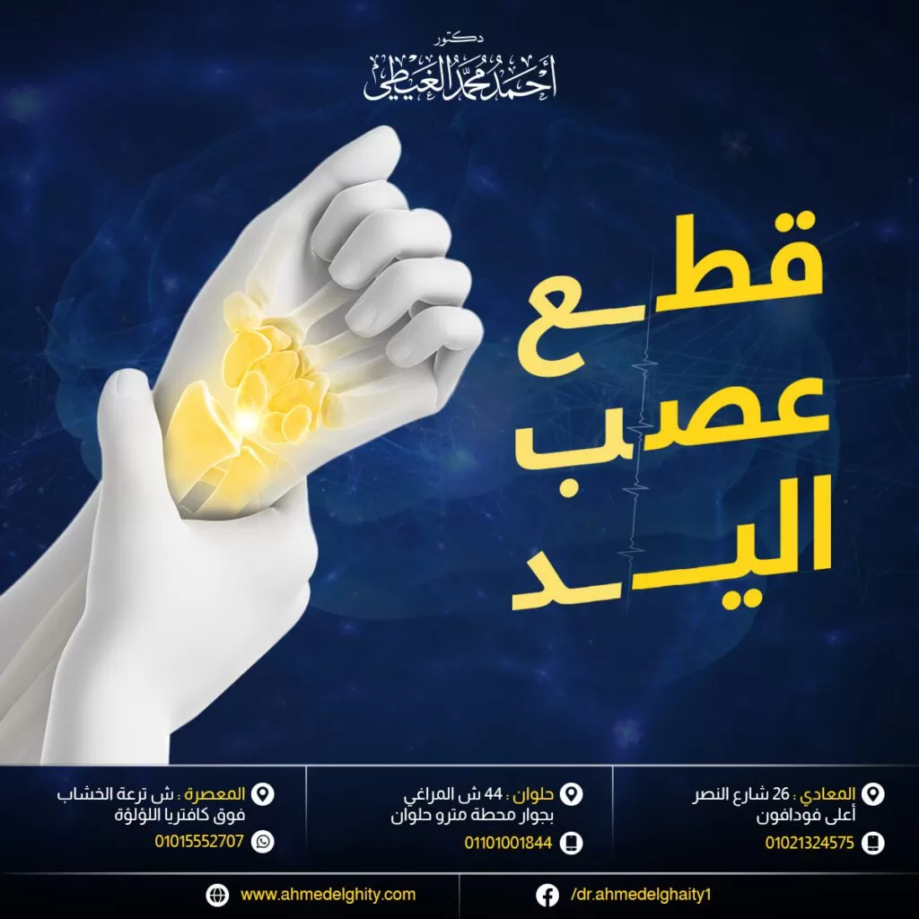 قطع عصب اليد