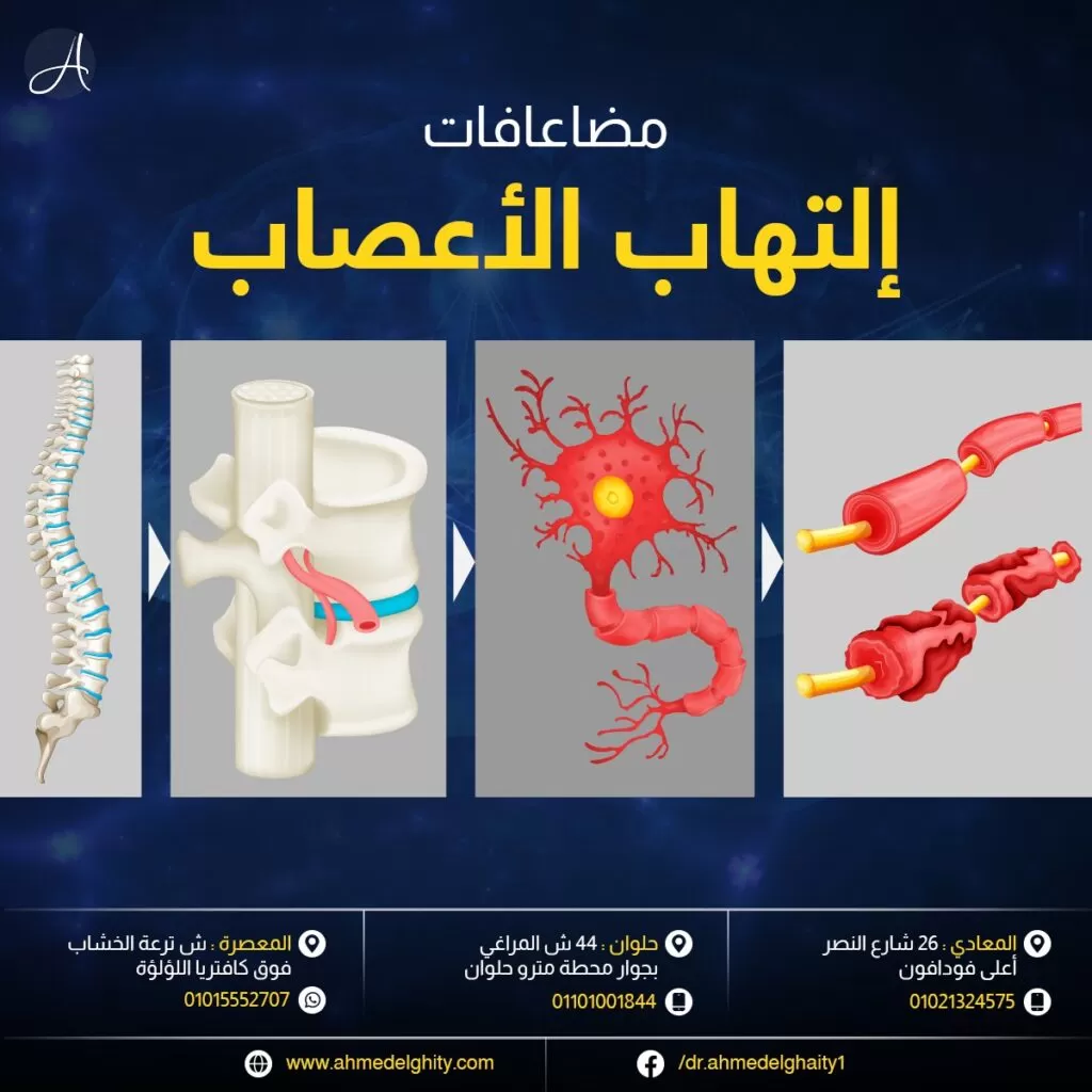 مضاعفات التهاب الأعصاب