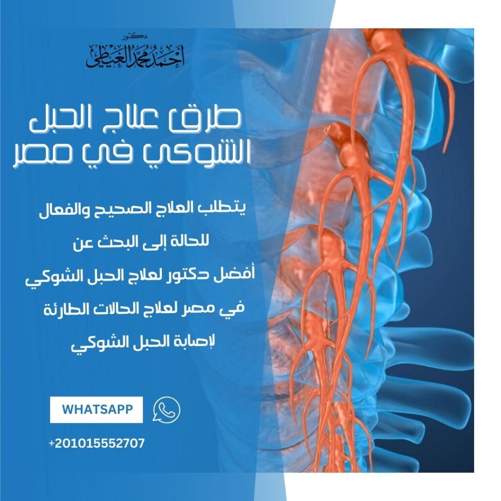 طرق علاج الحبل الشوكي في مصر