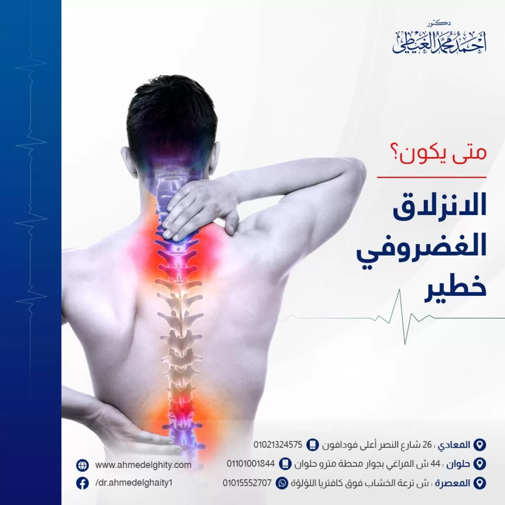 متى يكون الانزلاق الغضروفي خطير