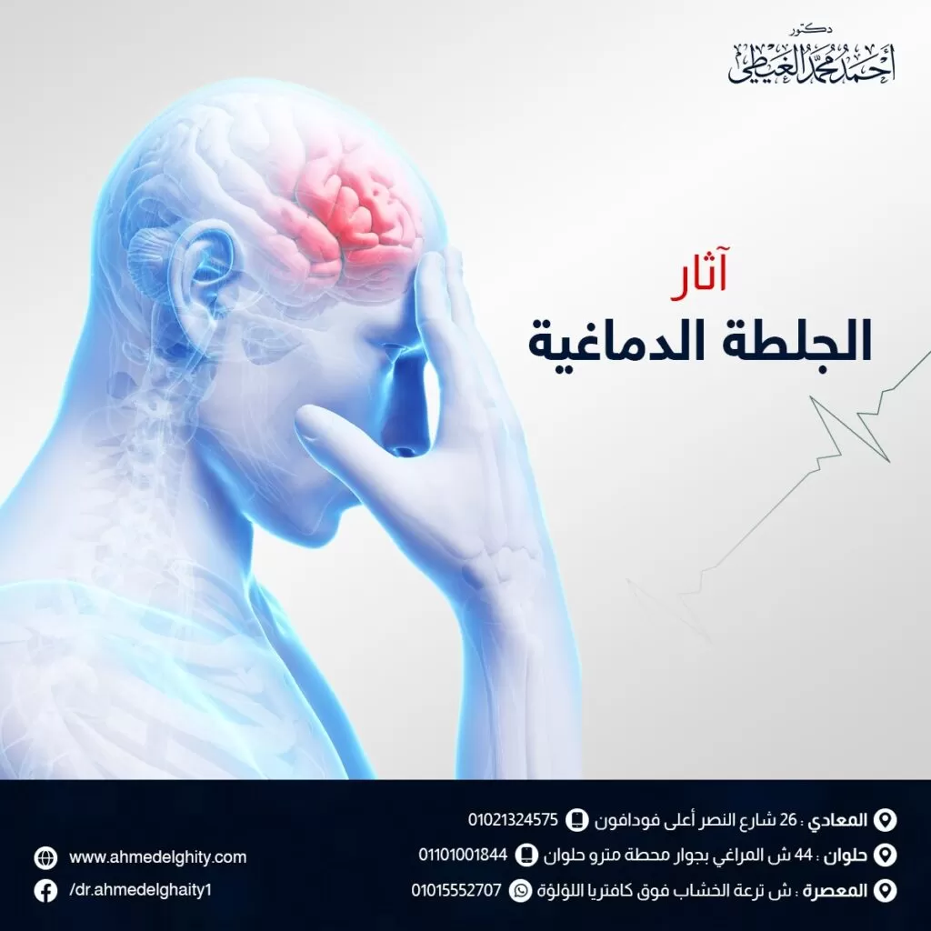 آثار الجلطة الدماغية