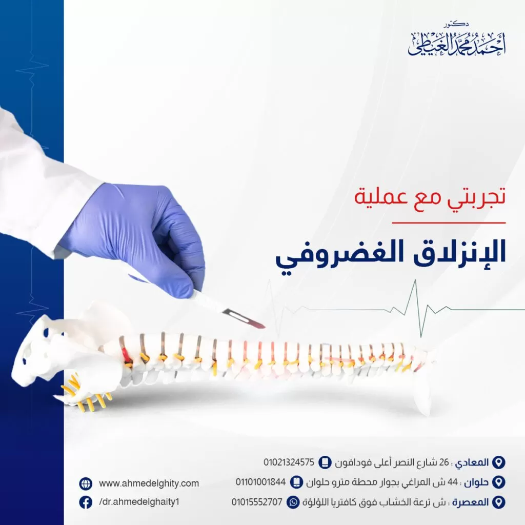 تجربتي مع عملية الانزلاق الغضروفي