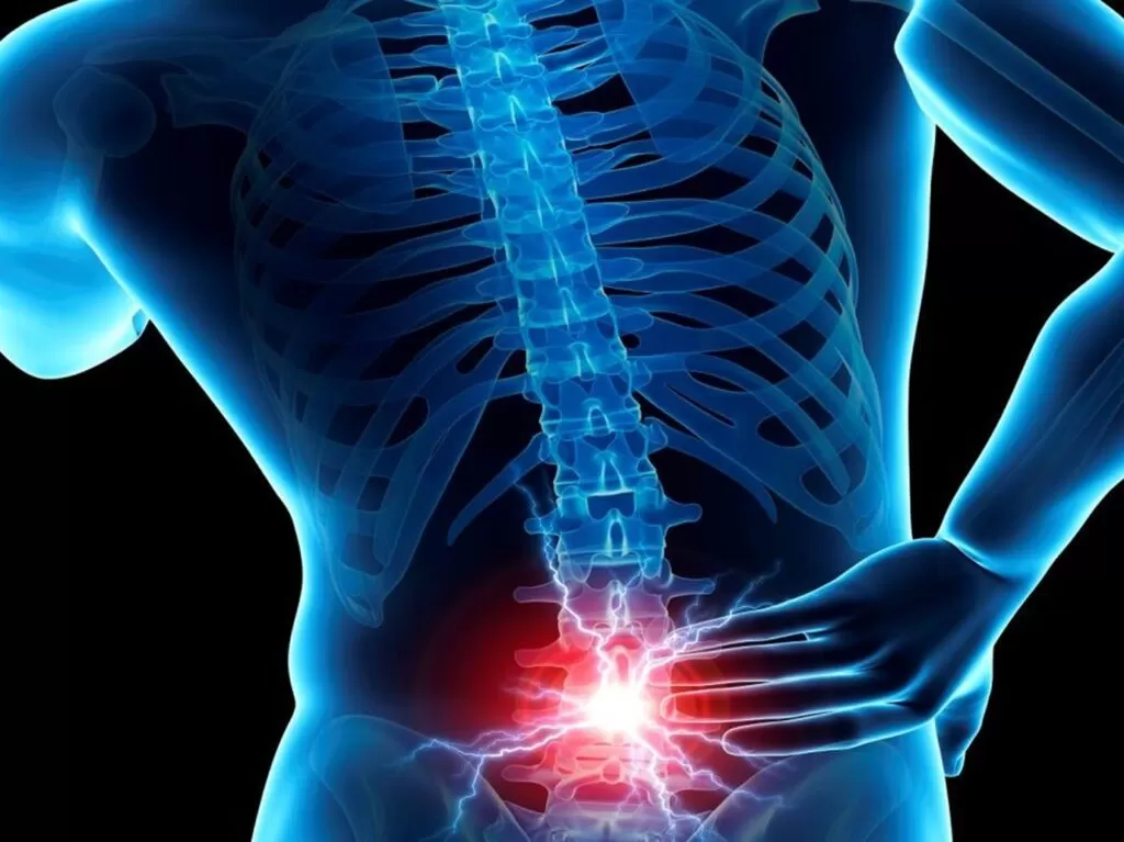 تجربتي مع عملية الانزلاق الغضروفي (بعد الجراحة)