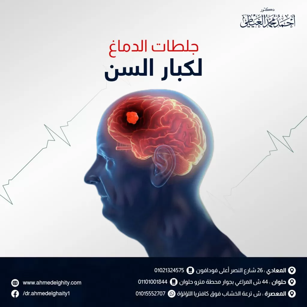 جلطات الدماغ لكبار السن جلطات الدماغ لكبار السن قد تحدث جلطات الدماغ لكبار السن بشكل مفاجئ نتيجة حدوث اضطراب في تدفق الدم إلى الدماغ، وعدم حصول خلايا المخ على كفايتها من الأكسجين لفترة من الوقت. ومع ذلك، كلما زادت تلك الفترة، كلما زادت خطورة الوضع وقلت نسبة التعافي من الجلطة. وإليكم أسباب الإصابة بالجلطة الدماغية، ومدى تأثيرها على كبار السن. تابعوا معنا في هذا المقال من خلال موقع دكتور أحمد الغيطي. جدول المحتويات ما هي جلطات الدماغ لكبار السن؟ أبرز علامات جلطات الدماغ لكبار السن أنواع الجلطات الدماغية السكتة الدماغية الإقفارية السكتة الدماغية النزفية مضاعفات جلطات الدماغ لكبار السن أسباب الجلطات الدماغية لكبار السن اسباب يمكن التحكم بها أسباب لا يمكن التحكم بها علاج جلطات الدماغ لكبار السن علاج السكتة الدماغية الإقفارية علاج السكتة الدماغية النزفية نصائح للمصاب بالجلطة الدماغية بعد التعافي ما هي جلطات الدماغ لكبار السن؟ تحدث الجلطة الدماغية نتيجة تعذر التدفق الدموي إلى الدماغ، وبالتالي تقل كمية الأكسجين والمواد المغذية التي ينقلها الدم إلى خلايا الدماغ، مما ينتج عنه تلف خلايا الدماغ. ولكن في حالة إذا كان النقص في كمية الأكسجين لفترة قصيرة فقط، يمكن للخلايا إصلاح نفسها وتسمى في تلك الحالة سكتة دماغية عابرة أو تحذيرية تستغرق دقائق إلى ساعات. أما إذا ماتت خلايا الدماغ بالفعل، فلا يمكن إصلاحها وتتكون خلايا جديدة عوضاً عن ذلك. وفي حالة كبار السن يستغرق الأمر وقتاً أطول حيث تتكون تلك الخلايا الدماغية الجديدة ببطء مما ينتج عنه ظهور بعض العلامات الدالة على الإصابة بالجلطة الدماغية. أبرز علامات جلطات الدماغ لكبار السن أبرز علامات جلطات الدماغ لكبار السن يساعد التعرف على تلك العلامات في التصرف السريع مع المريض، مما يحدث فرقاً كبيراً في تأثير الجلطة على كبار السن، لذلك عند ظهور إحدى تلك العلامات لابد من الذهاب إلى الطوارئ سريعاً، وتتضمن تلك العلامات مايلي: احجز موعدك مع دكتور أحمد الغيطي تشويش او ازدواجية الرؤية بإحدى العينين أو كلتيهما. الشعور بصداع ودوار شديد ومفاجئ. فقدان التوازن والتنسيق. صعوبة في الحركة والكلام. ضعف في عضلات الوجه أو الساق أو الذراع، وعادة ما يكون في جانب واحد من الجسم. تشنجات. وتعد الإصابة بالجلطة الدماغية أحد الأسباب الشائعة للوفاة أو العجز خاصة لكبار السن خاصة وأنهم الفئة الأكثر عرضة للإصابة بشكل عام. وأفادت بعض التقارير الطبية أن 66% ممن يذهبون إلى المستشفيات على أثر الإصابة بالجلطات الدماغية يبلغون من العمر 65 عاماً أو أكثر. يستطيع العديد من مرضى السكتة الدماغية الذين تعافوا بالفعل استعادة الوظائف الحياتية بمرور الوقت، ومع ذلك يعاني حوالي 25٪ من الناجين من إعاقة طفيفة و40٪ يعانون من إعاقة متوسطة إلى شديدة. ومن الملاحظ أن النساء يمتلكن أعراض سكتة دماغية مختلفة بعض الشيء عن الرجال، كما أن معدل وفيات النساء نتيجة الجلطة الدماغية أعلى من الرجال، حيث تتعرض 60٪ من النساء إلى الوفاة من السكتة الدماغية مقابل 40٪ من الرجال. وتتمثل تلك الأعراض الإضافية في: الشعور بغثيان مفاجئ. ضعف عام مفاجئ. ألم مفاجئ في الصدر، وضيق في التنفس. خفقان مفاجئ. اقرأ أيضًا: مدة غيبوبة الجلطة الدماغية أنواع الجلطات الدماغية تنقسم الجلطات الدماغية التي تصيب كبار السن إلى نوعان رئيسيان: السكتة الدماغية الإقفارية وتعد النوع الأكثر شيوعًا من حالات الجلطة الدماغية نتيجة حدوث تضيق في الأوعية الدموية وانخفاض تدفق الدم إلى الدماغ، وعدم وصول كمية كافية من الأكسجين والمواد المغذية إلى خلايا الدماغ ويحدث ذلك للأسباب الآتية: حدوث تجلط للدم في وعاء دموي في الدماغ أو الرقبة. انتقال الجلطة من جزء آخر من الجسم، مثل القلب إلى العنق أو الدماغ. تضيق الأوعية الدموية في الدماغ نتيجة كثرة الترسبات الدهنية المبطنة لجدران الشرايين. السكتة الدماغية النزفية تحدث نتيجة انفجار الأوعية الدموية وتسرب الدم إلى الدماغ أو حوله، وبالتالي يقل توصيل الأكسجين والمغذيات إلى خلايا المخ وتعرض أنسجة المخ إلى بعض المواد السامة قد تتسبب في موت الخلايا. قد يتسبب ذلك النزيف أيضًا في زيادة الضغط داخل الجمجمة وعلى أنسجة المخ مما يتسبب في تلف الخلايا. مضاعفات جلطات الدماغ لكبار السن تحدث تلك المضاعفات في حالة عدم العلاج السريع للجلطة، وتتسبب في حالة تسمى الوذمة الدماغية نتيجة تراكم السوائل وزيادة الضغط داخل الجمجمة، مما يؤدي إلى تورم أنسجة الدماغ وتعد من أكثر المضاعفات شيوعاً تعد الوذمة الدماغية من المضاعفات الخطيرة والتي تهدد حياة المريض وخاصة كبار السن، لذلك فهي تحتاج إلى تدخل طبي سريع، وتتمثل أعراض الوذمة في: صداع شديد. الشعور بالغثيان والقيء. صعوبة في التنفس. تشوش الرؤية. فقدان الذاكرة. ألم شديد بالرقبة. أما عن المضاعفات الأخرى التي قد يصاب بها مريض الجلطة الدماغية، فهي: احتمال تكوين جلطات في أماكن أخرى مثل جلطات الأوردة العميقة أو الانسداد الرئوي. حدوث تشنجات نتيجة زيادة النشاط الكهربي في المخ. فقدان في الذاكرة. مشكلاتٍ في الرؤية والسمع. ضعف العضلات. معاناة المريض من اكتئاب حاد. ظهور قرح الفراش نتيجة قلة حركة المريض. الالتهاب الرئوي. عدوى الجهاز البولي. اضطرابات الأمعاء والمثانة. صعوبة الحركة، والكلام، والبلع، والتنفس. فقدان الإحساس. احتمال دخول المريض في غيبوبة. أسباب الجلطات الدماغية لكبار السن أسباب الجلطات الدماغية لكبار السن قد تحدث الجلطات الدماغية لعدة أسباب بعضها يمكن التحكم بها، والبعض الآخر لا يمكن للمريض ان يتحكم فيها، وتشمل: اسباب يمكن التحكم بها التدخين: يؤثر بشكل أساسي على القلب والأوعية الدموية من خلال إطلاق النيكوتين وثاني اكسيد الكربون، مما يزيد من خطر الإصابة بالجلطة الدماغية. السكري: مرضى داء السكري أكثر عرضة للإصابة بالجلطة الدماغية مرتين أكثر من غيرهم، حيث يتسبب ارتفاع مستوى الجلوكوز في الدم بدلاً من الخلايا إلى حدوث جلطات دموية. ارتفاع ضغط الدم: يعد أحد أهم أسباب الإصابة بجلطات الدماغ لكبار السن، حيث يتسبب في تلف الشرايين، وزيادة احتمالات انسداد الشرايين الضعيفة في الدماغ أو انفجارها. أسباب لا يمكن التحكم بها العمر: يعد كبار السن هم الفئة الأكثر تعرضاً للإصابة بالجلطات الدماغية وخاصة من النساء. الوراثة: قد يتسبب وجود تاريخ عائلي من الإصابة بالجلطات الدماغية في زيادة احتمالات الإصابة. اقرأ أيضًا: متى يموت مريض الجلطة الدماغية؟ علاج جلطات الدماغ لكبار السن يعتمد العلاج على نوع الجلطة التي يصاب بها المريض، ويتضمن الآتي: علاج السكتة الدماغية الإقفارية تمثل الأدوية الاختيار الأكثر شيوعاً في علاج ذلك النوع من الجلطات، مثل مضادات التخثر: تمنع تكون جلطات جديدة، وتقوم بإذابة الجلطة التي تمنع تدفق الدم إلى خلايا الدماغ خاصة منشط البلازمينوجين النسيجي (t-PA) والذي يعطى للمريض في غضون 3 ساعات من الإصابة. علاج السكتة الدماغية النزفية يعتمد العلاج هنا على العثور على مصدر النزيف والسيطرة عليه إما عن طريق الجراحة أو بعض الإجراءات الأخرى التي تساعد في وقف النزيف وتخفيف الضغط على الدماغ، وإصلاح تلف الشرايين والتشوهات الدماغية، وتشمل: احجز موعدك مع دكتور أحمد الغيطي القسطرة: داخل الشريان المسدود لتحسين تدفق الدم إلى خلايا المخ. الدعامة: لفتح الشريان المسدود وضمان عدم ضيقه مرة اخرى. استئصال باطنة الشريان السباتي: لإزالة الرواسب الدهنية التي تسد الشرايين السباتية. استئصال التخثر الدموي: عن طريق شفط الجلطة أو سحبها. نصائح للمصاب بالجلطة الدماغية بعد التعافي تساعد تلك الإرشادات في تحسين صحة المريض بعد التعافي، وتتمثل في: اتباع نظام غذائي صحي. ممارسة التمارين الرياضية. تجنب تناول الكحوليات والتدخين. العلاج الوظيفي لتحسين المهارات الحركية والتوازن. علاج النطق حتى يستعيد المريض قدرته على الكلام بشكل مفهوم. العلاج المهني لاستعادة المهارات الحياتية التي فقدوها أثناء المرض. الخلاصة يجب الوضع في الاعتبار أن جلطات الدماغ لكبار السن تحدث بمعدل أكبر وأكثر خطورة من الفئات العمرية الأقل، لذلك يجب مراعاة الأشخاص المعرضون للإصابة بمنتهى الحرص والتأكد من الحصول على الرعاية الطبية العاجلة في حالة ظهور علامات الجلطة الدماغية. مراجع داخلية: ورم المخ الحميد أورام المخ