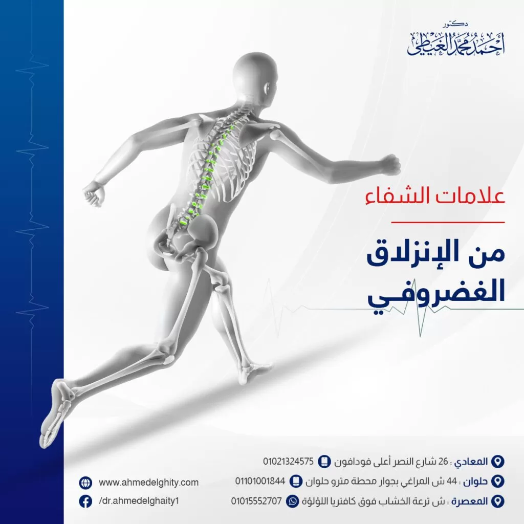 علامات الشفاء من الانزلاق الغضروفي