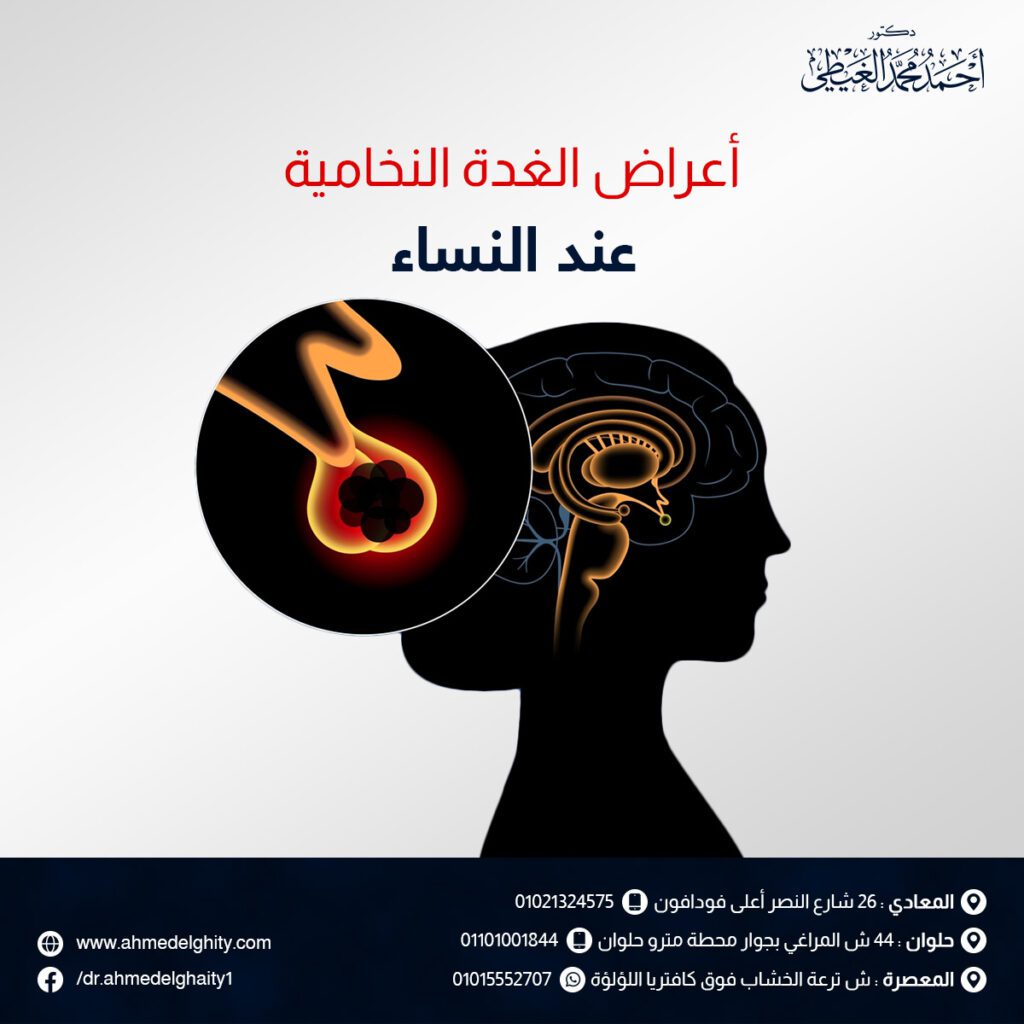 أعراض الغدة النخامية عند النساء