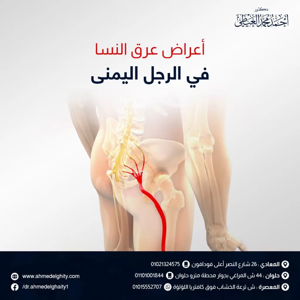 أعراض عرق النسا في الرجل اليمنى