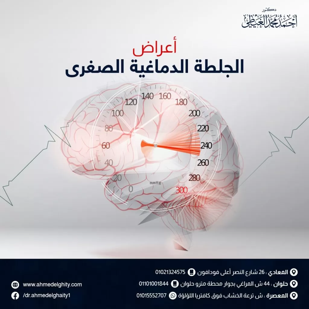 اعراض الجلطة الدماغية الصغرى