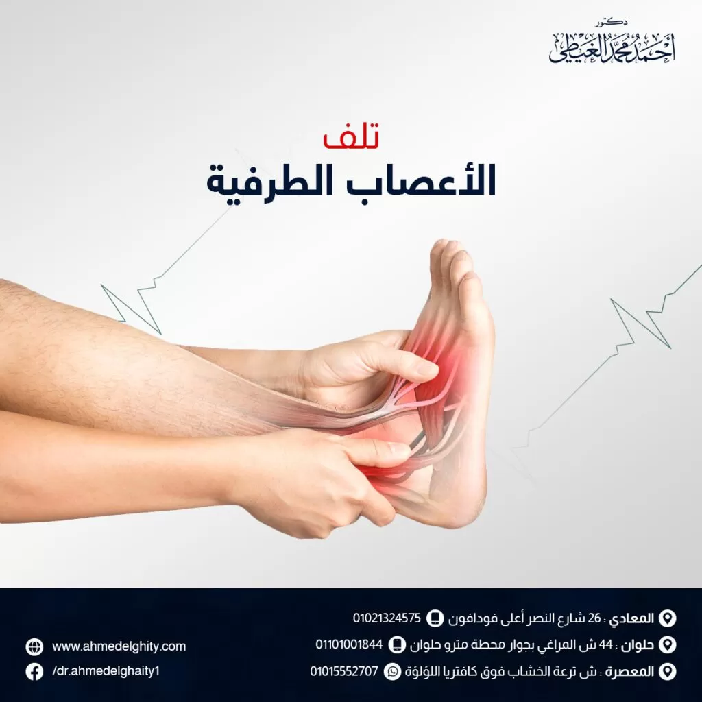 تلف الاعصاب الطرفية