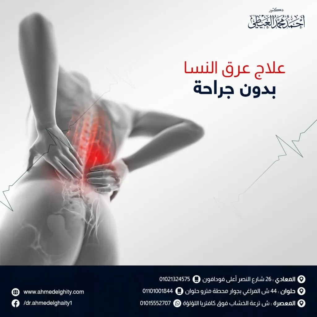 علاج عرق النسا بدون جراحة