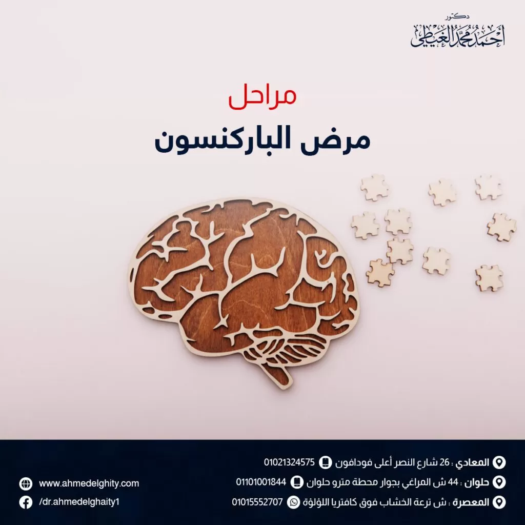 مراحل مرض الباركنسون