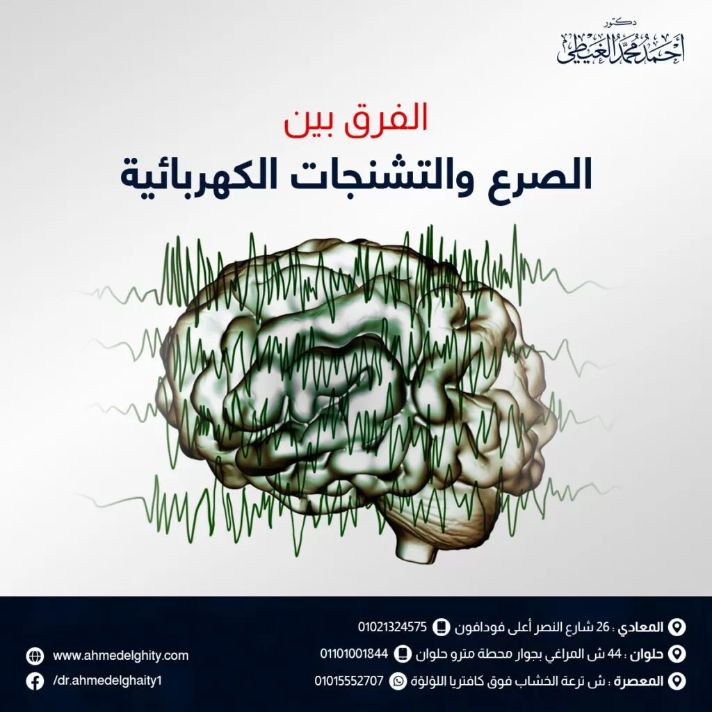 الفرق بين الصرع والشحنات الكهربائية