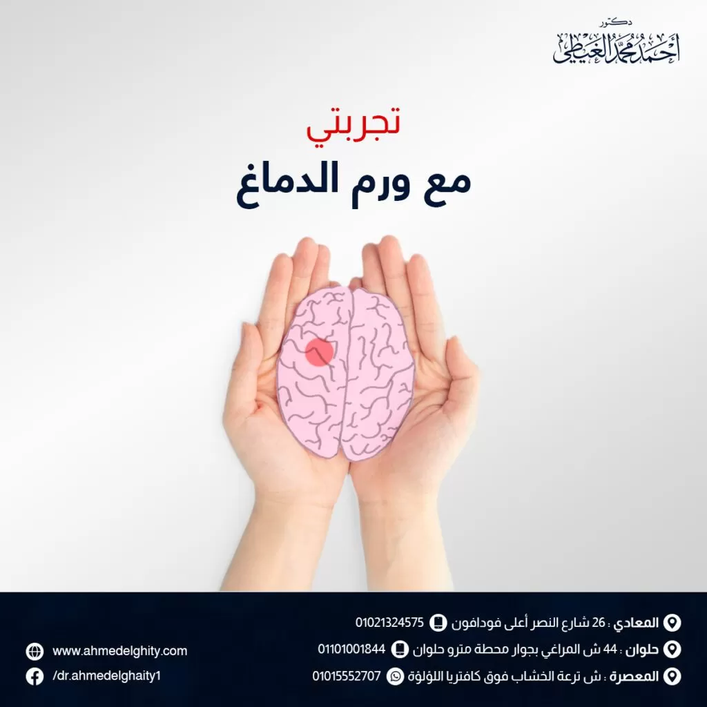 تجربتي مع ورم الدماغ