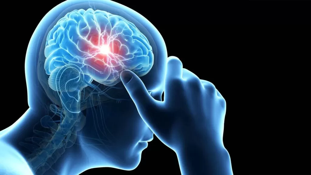 تشخيص وعلاج الصرع البسيط