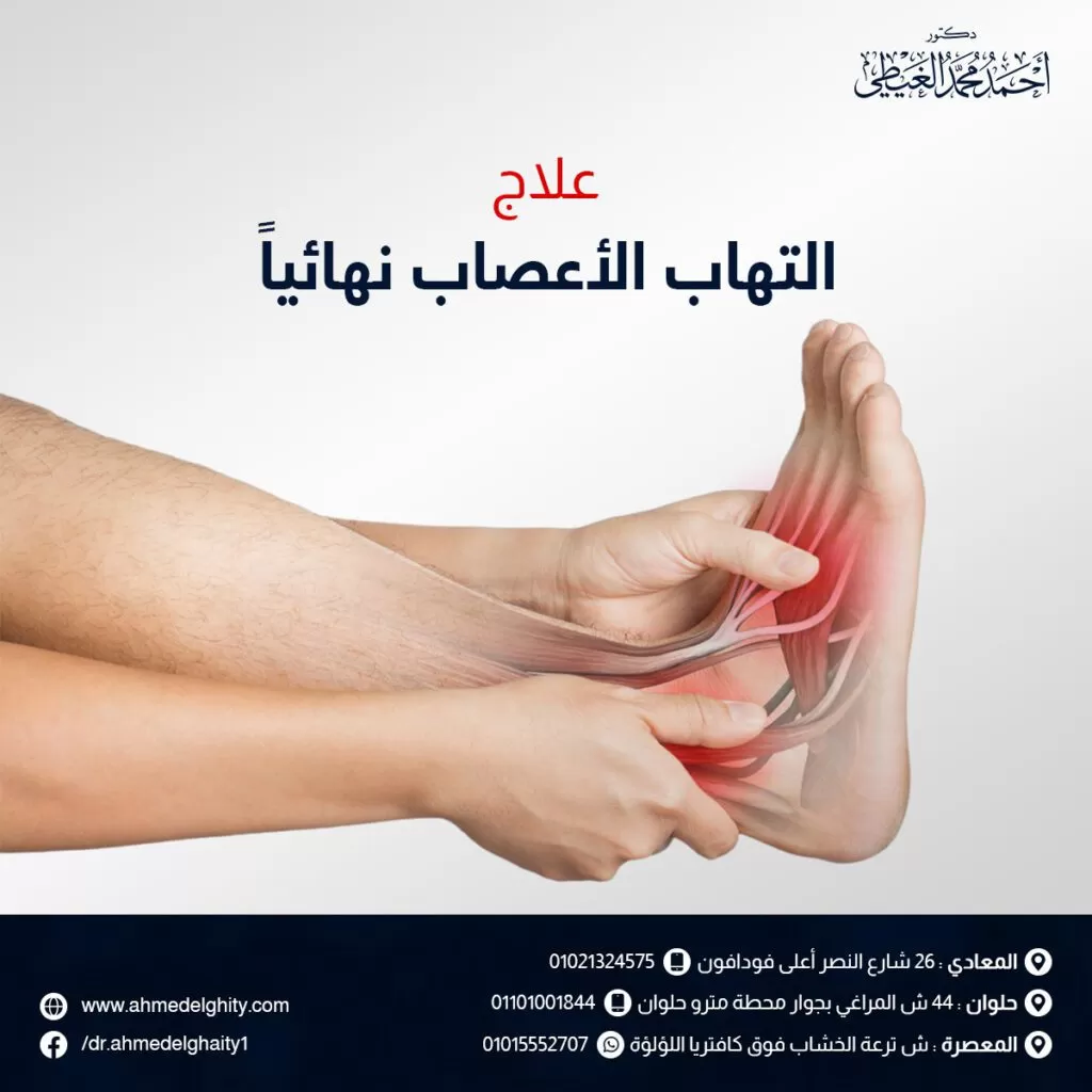 علاج التهاب الأعصاب نهائيا