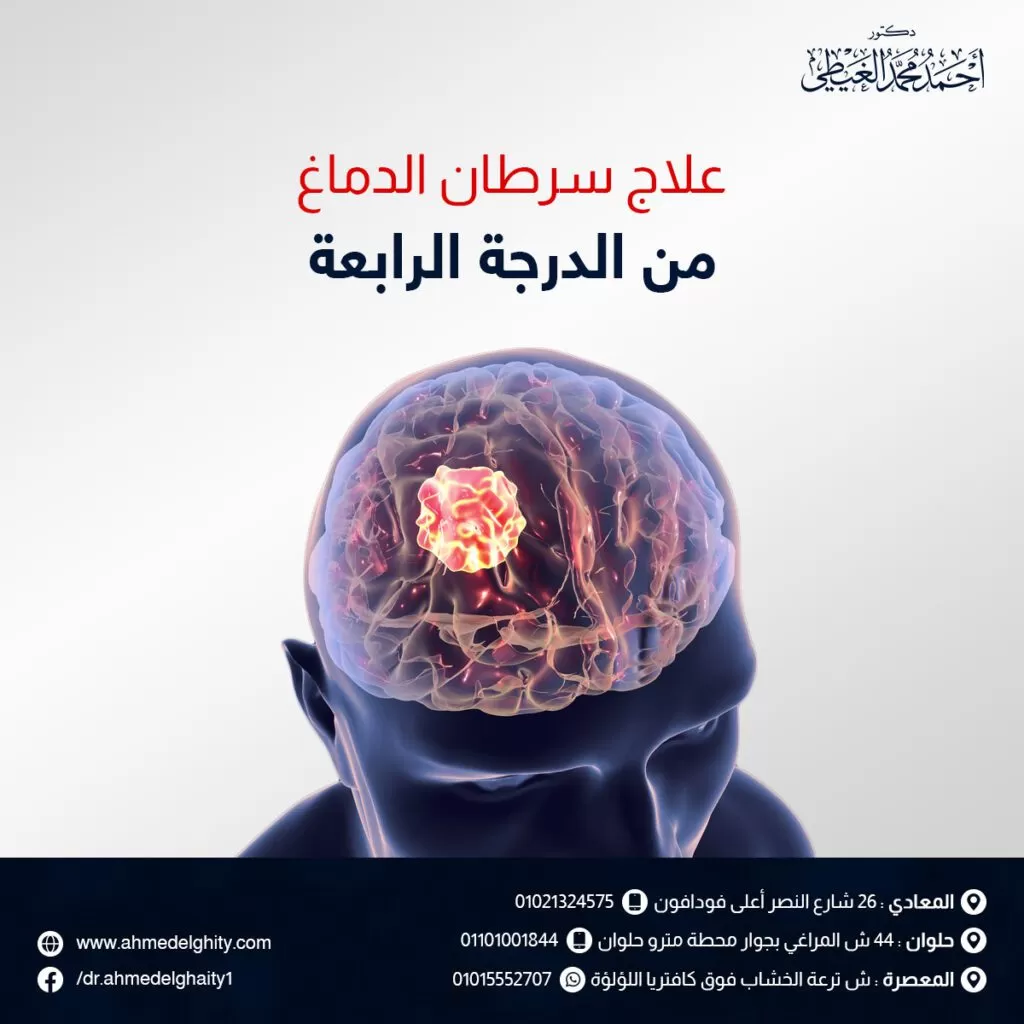 علاج سرطان الدماغ من الدرجة الرابعة