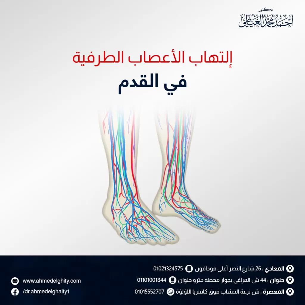 التهاب الأعصاب الطرفية في القدم