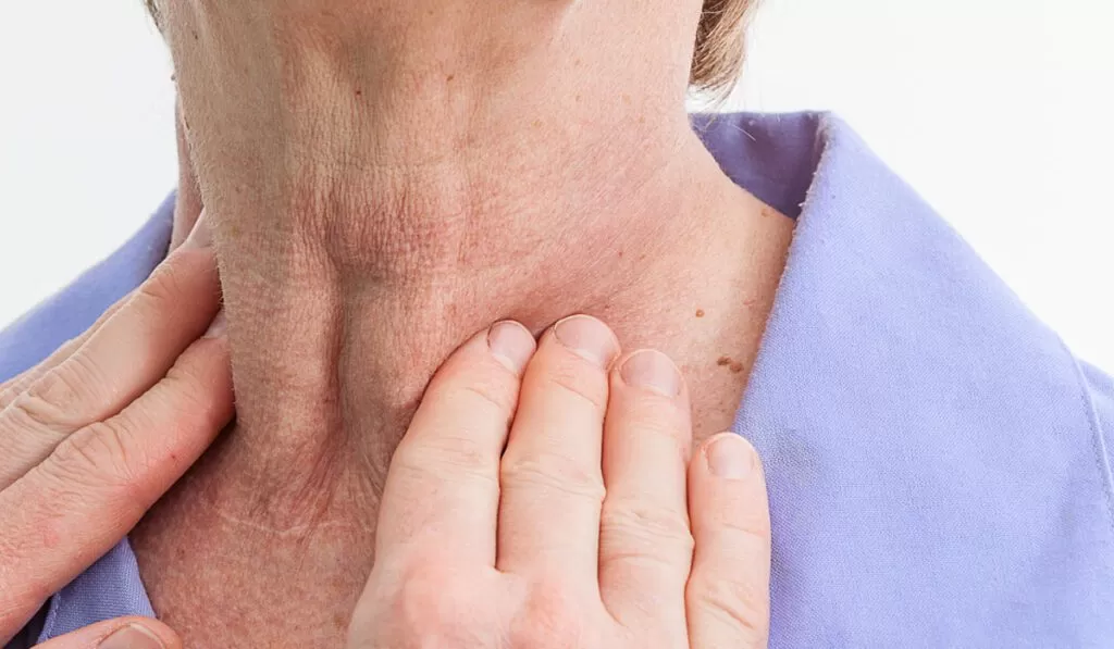 الوقاية من أعراض انسداد الشريان السباتي في الرقبة