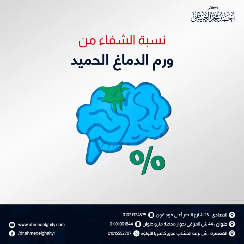 نسبة الشفاء من ورم الدماغ الحميد