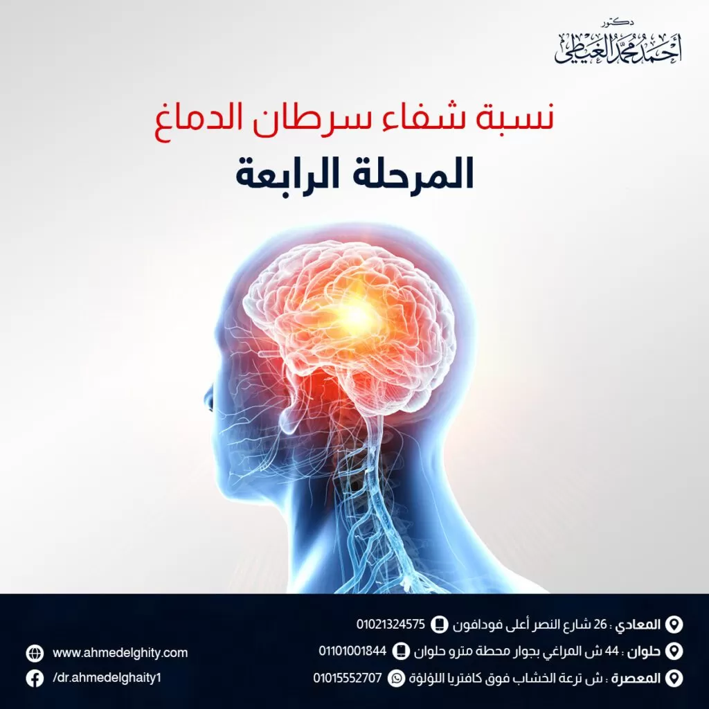 نسبة شفاء سرطان الدماغ المرحلة الرابعة