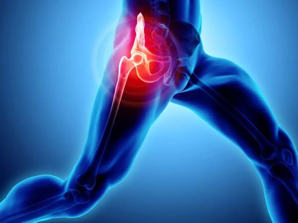 أعراض التهاب المفصل العجزي الحرقفي