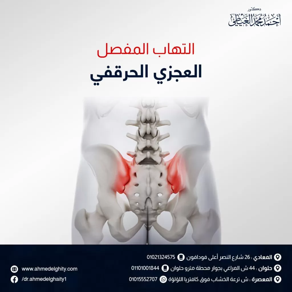 التهاب المفصل العجزي الحرقفي