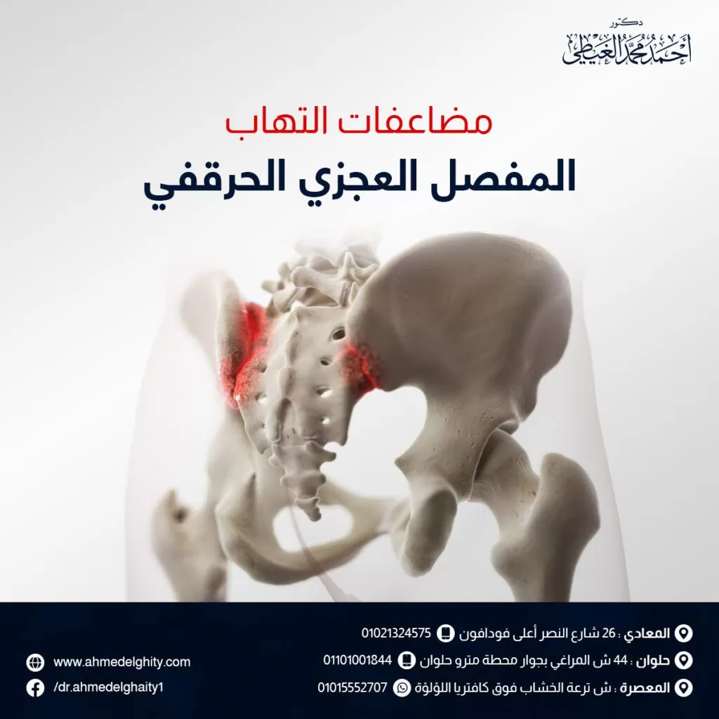 مضاعفات التهاب المفصل العجزي الحرقفي