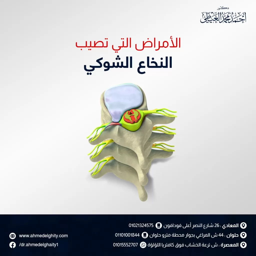 الامراض التي تصيب النخاع الشوكي