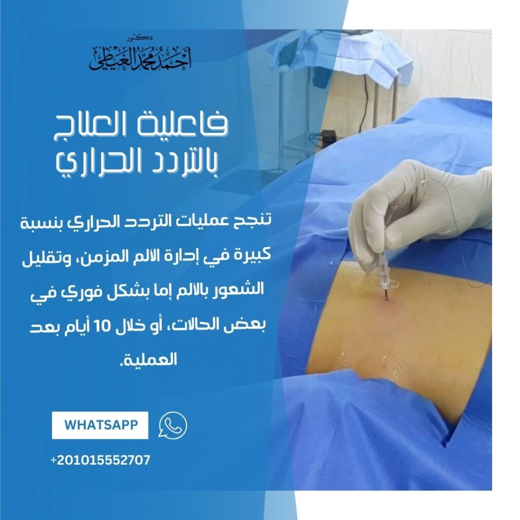 فاعلية العلاج بالتردد الحراري
