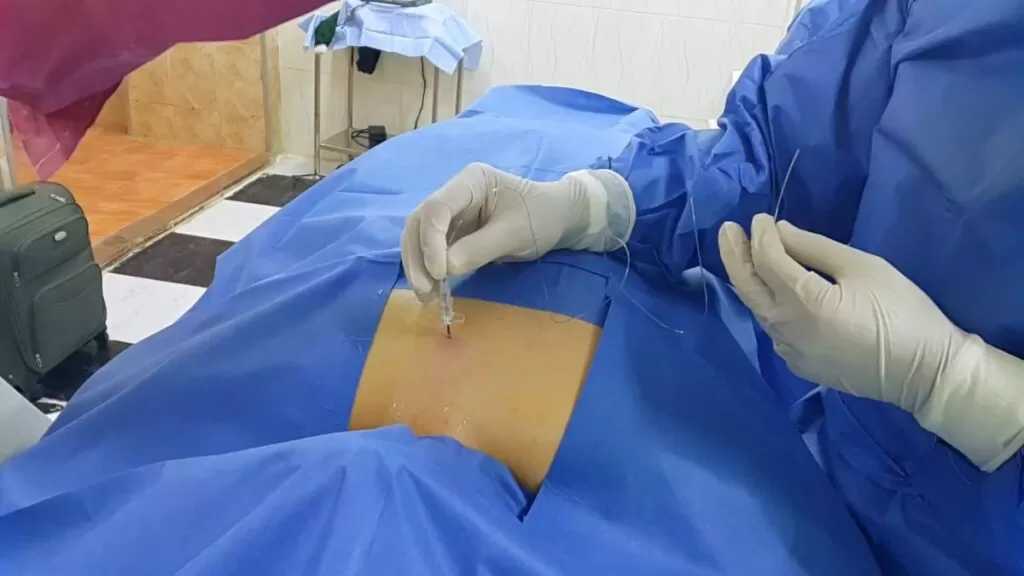 كيف يتم إجراء التردد الحراري؟