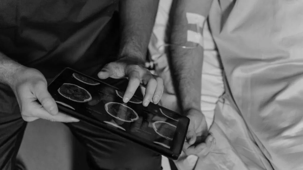 أعراض الناسور الشرياني الوريدي المخي