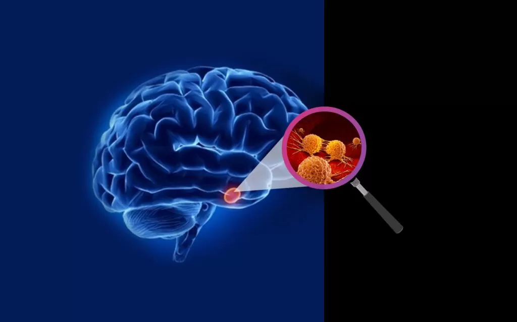 أعراض ناتجة عن زيادة الضغط على الجمجمة