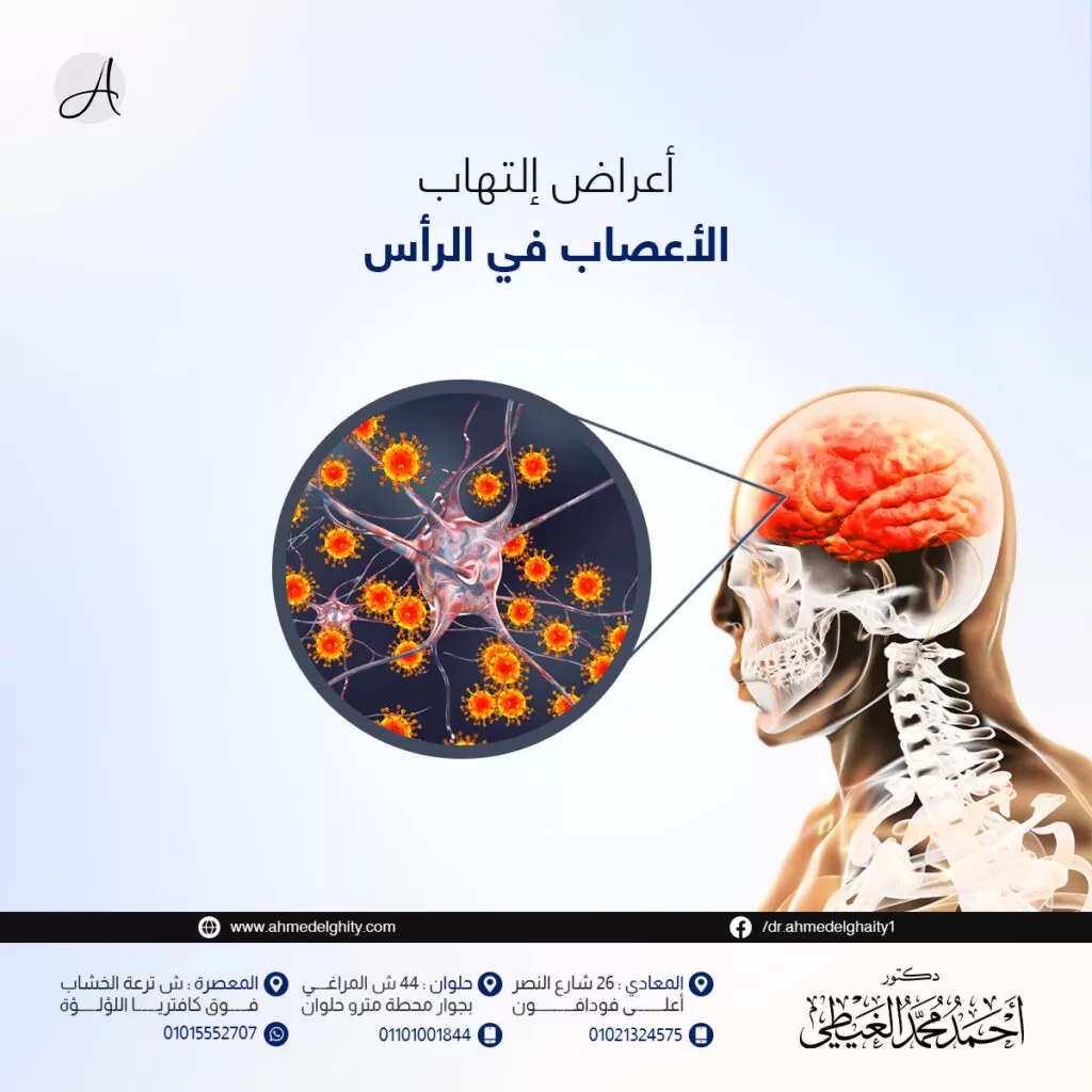 أعراض التهاب الأعصاب في الرأس