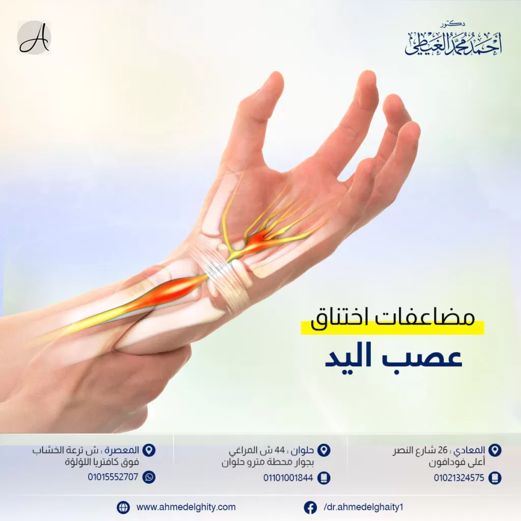 أسباب تنميل اليد اليمنى