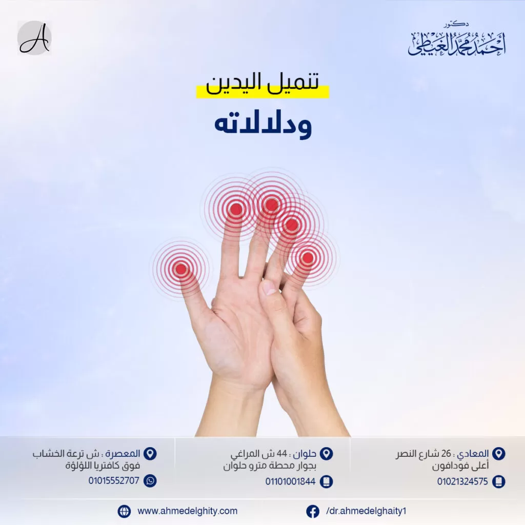 أسباب تنميل اليد اليمنى نادرة الحدوث