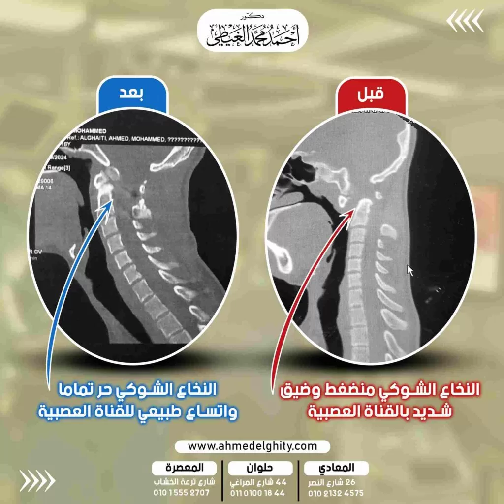 العملية الجراحية