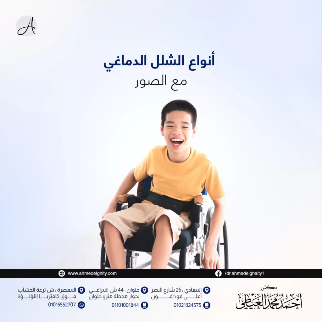 انواع الشلل الدماغي مع الصور