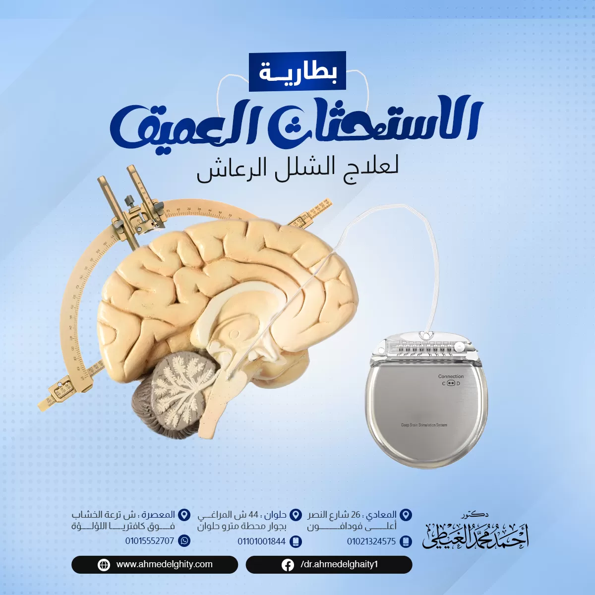 هل الشلل الرعاش خطير؟